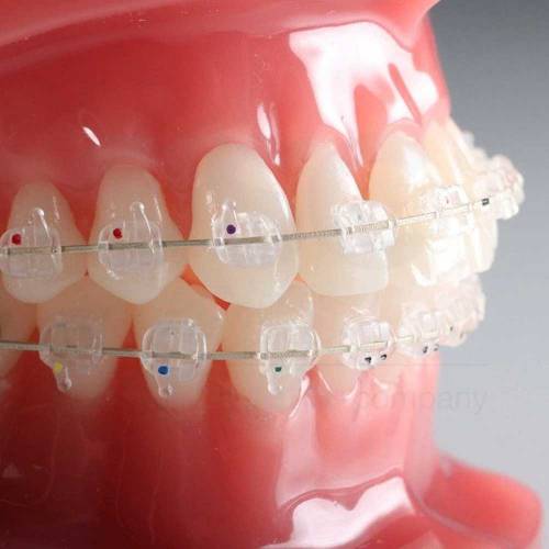 OPTYC Ceramic MBT .022 Upper Right Lateral - OSC