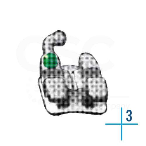 .018 Upper Right Cuspid with Hook Hilgers Sinterline Plus - OSC