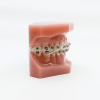 Intra-Oral Latex Elastics 1/8" Light 2.5 ounce (5000)